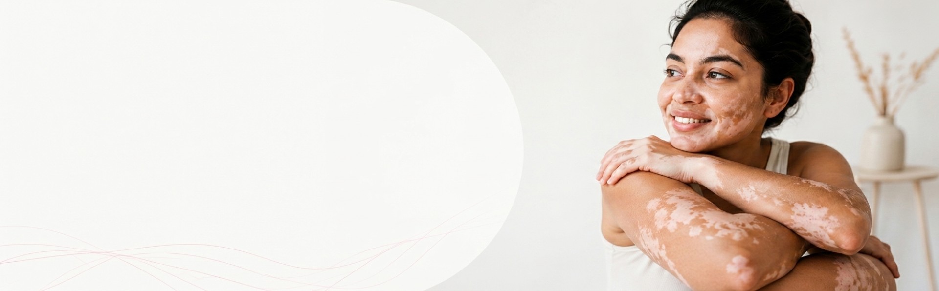 Effective Treatment for Vitiligo