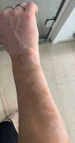 Julia - Before Treatment